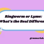 Ringworm or Lyme: What’s the Real Difference