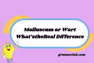 Molluscum or Wart